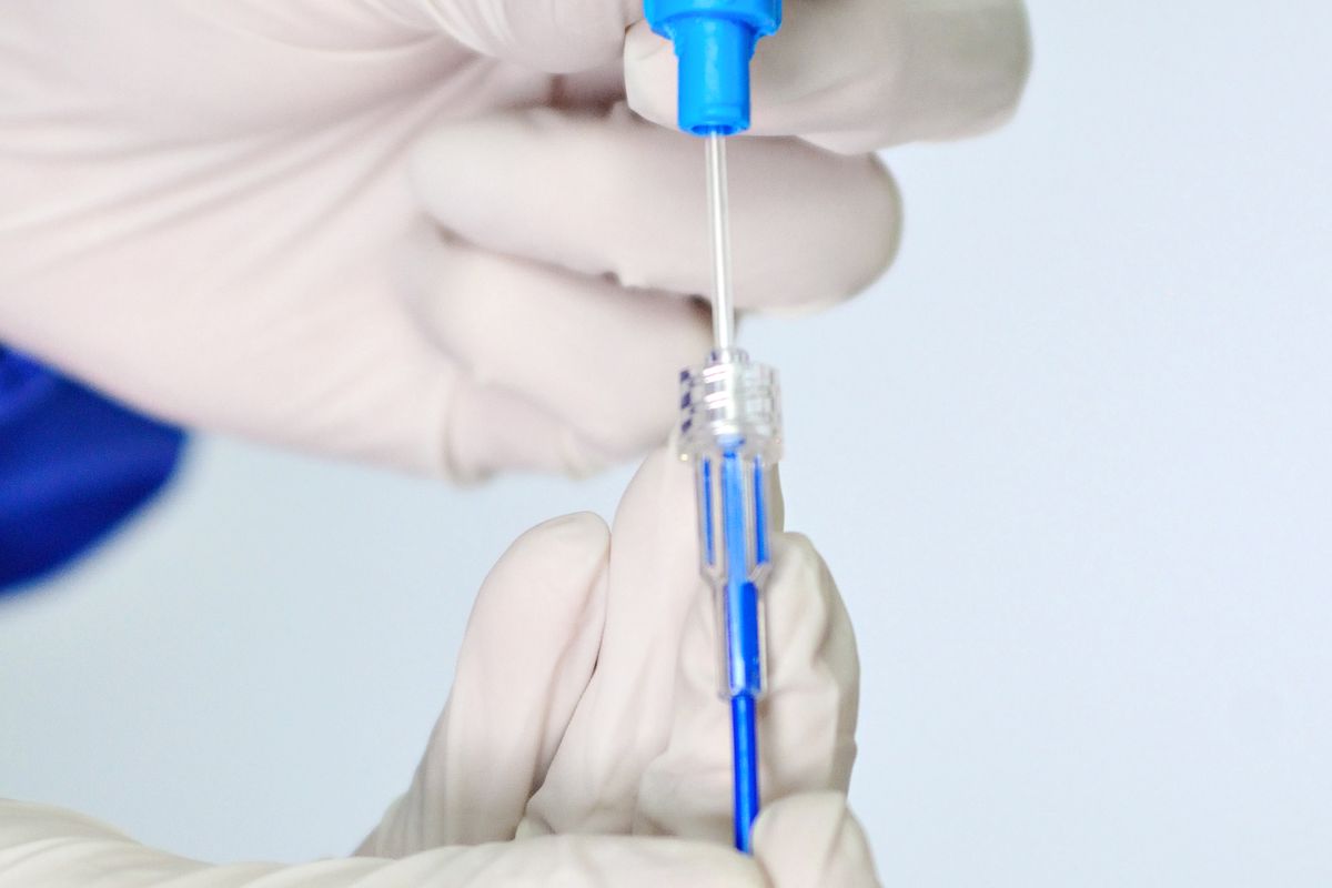 Ablacioni me Vein Glue (VenaX) — Klinika Ime