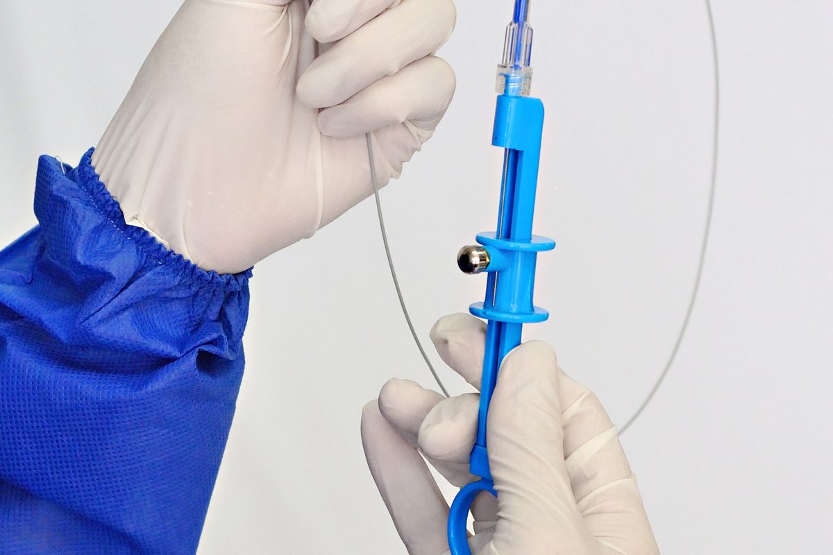 Stentimi i arteries karotide (CAS) — Klinika Ime